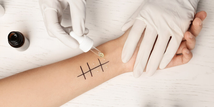 Allergiediagnostik in Hamburg